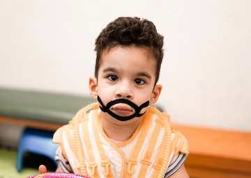 Tape Orofacial_1 Tape Orofacial